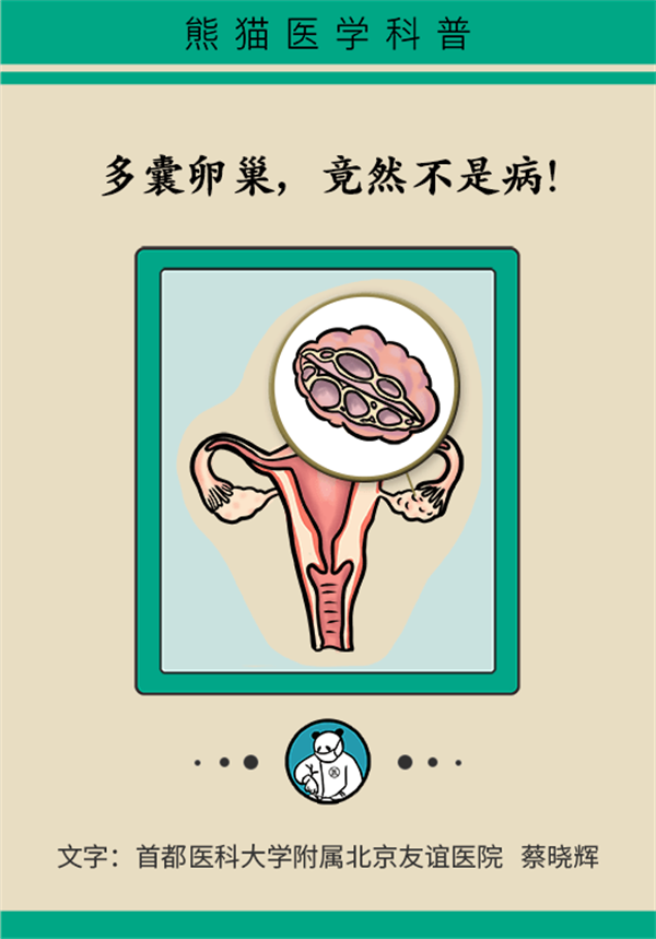 得了多囊卵巢綜合征怎麼辦？這些調理建議需了解