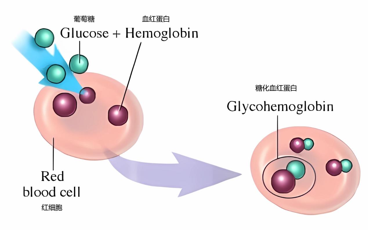 糖化血紅蛋白（圖片來源：Polymorphism of aldose reductase gene and susceptibility for developing diabetic retinopathy among type 2 diabetes mellitus patients）