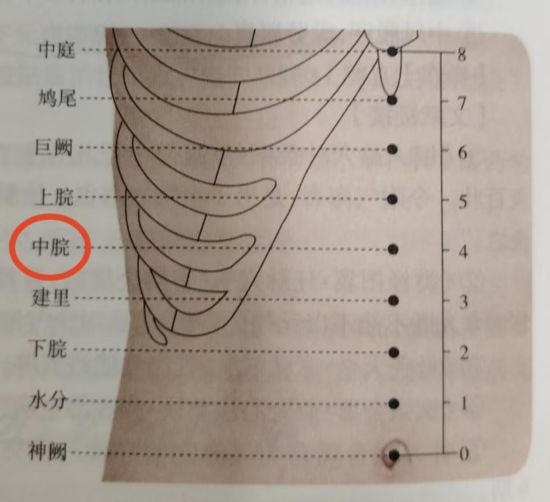圖中標紅中脘穴。（受訪者供圖）