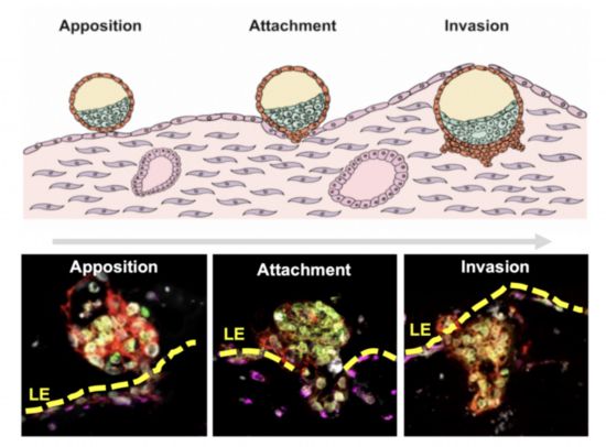 首次实现人类胚胎着床全过程体外模拟。（研究团队供图）
