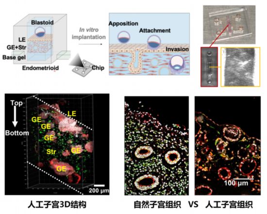 体外构建人类3D子宫模型。（研究团队供图）